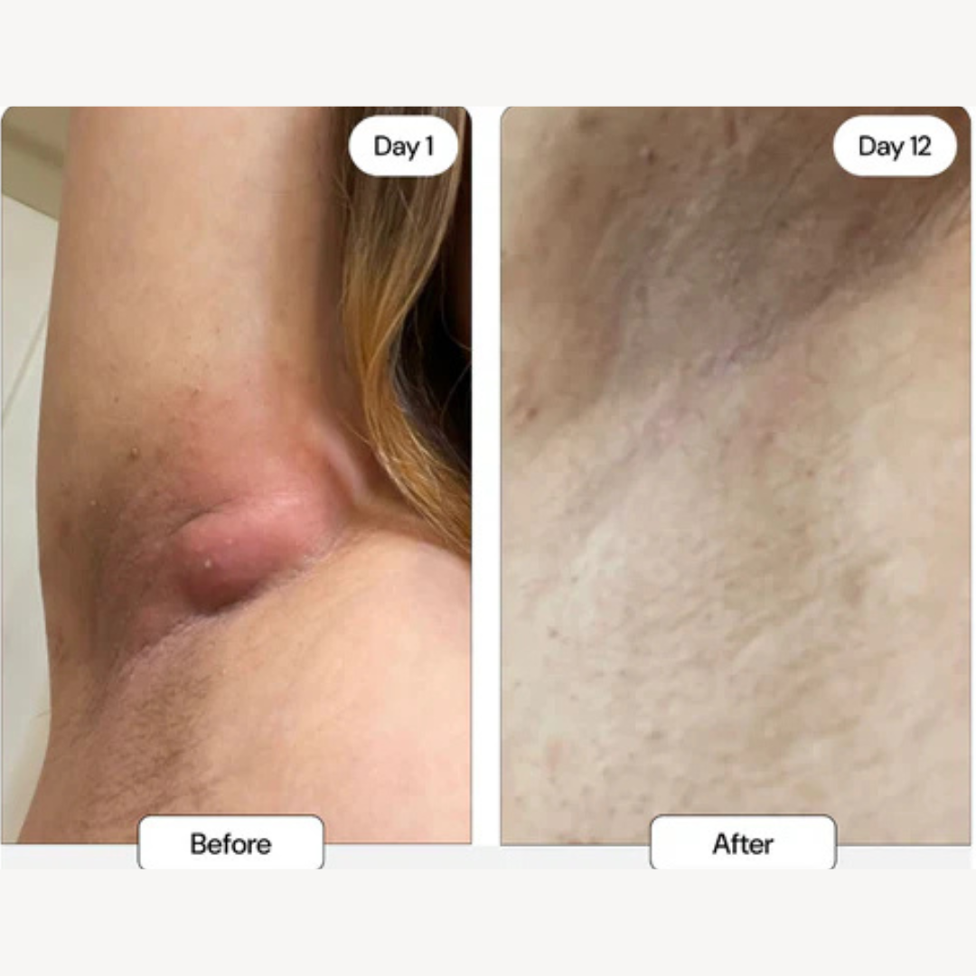 “Cannot believe how fast this works”