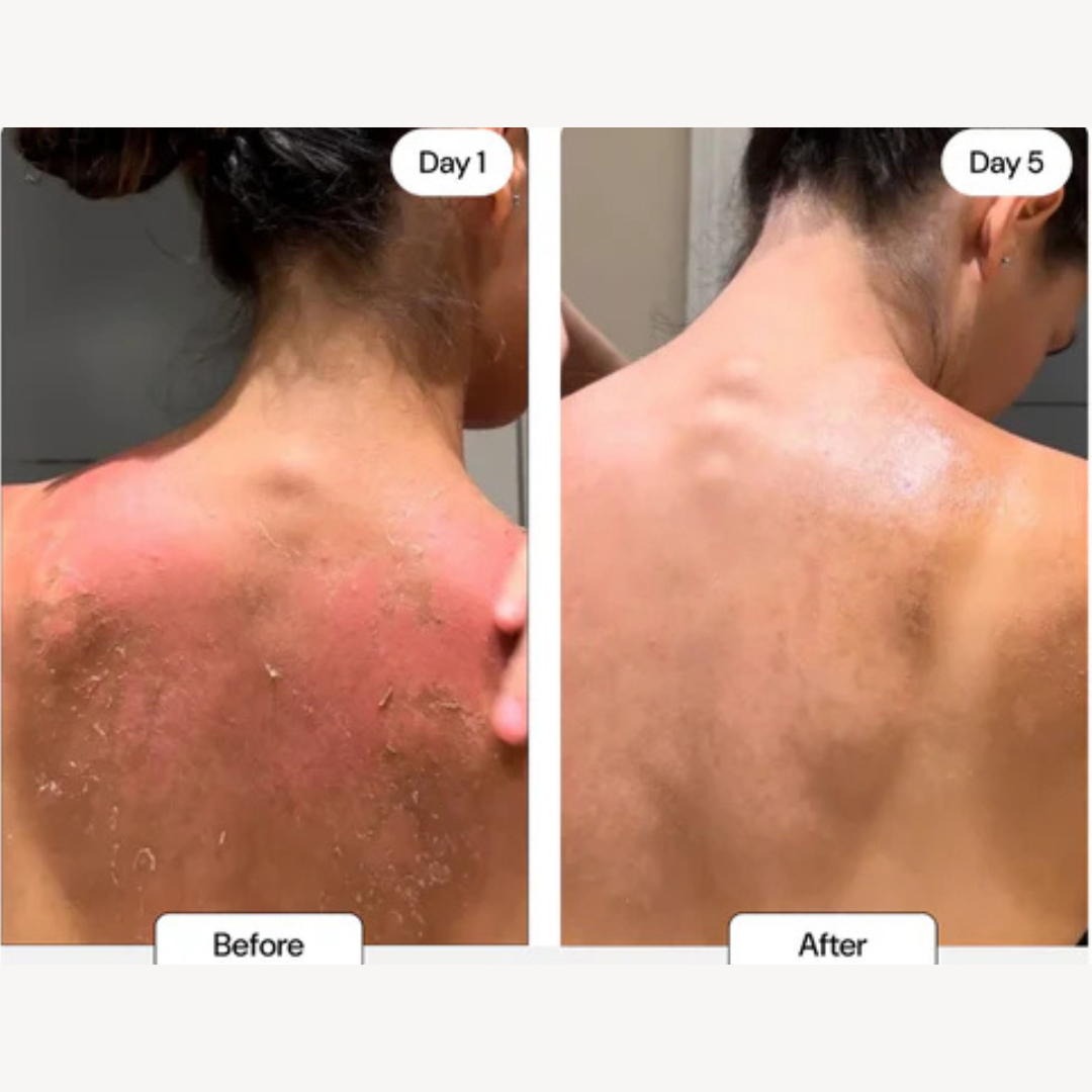 &#39;&#39;Results overnight!&#39;&#39;