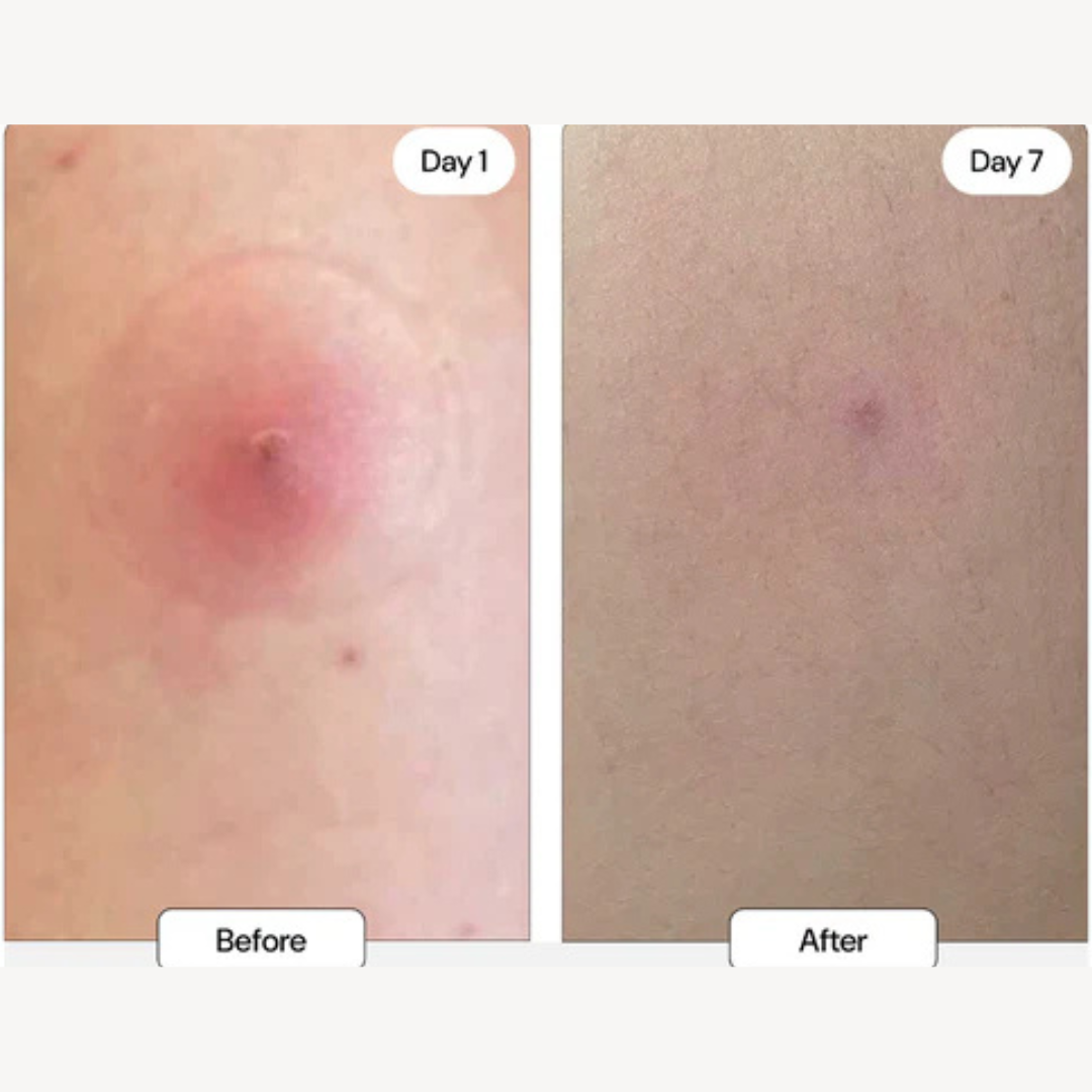 “I felt instant relief!”