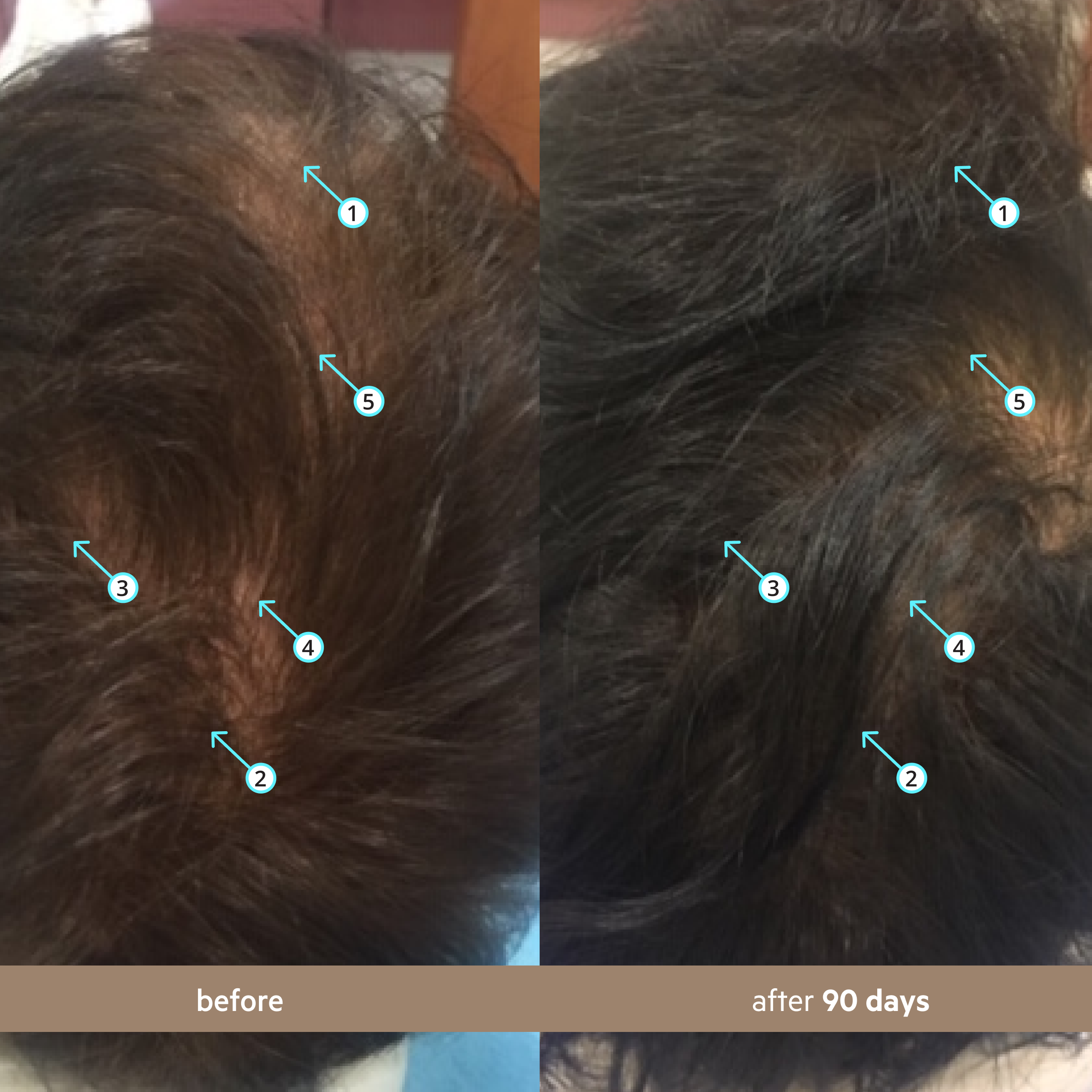 Spectral Men's (DNC-N) | Hair Density Serum with Nanoxidil 5%
