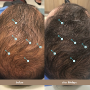 Spectral Men's (DNC-N) | Hair Density Serum with Nanoxidil 5%
