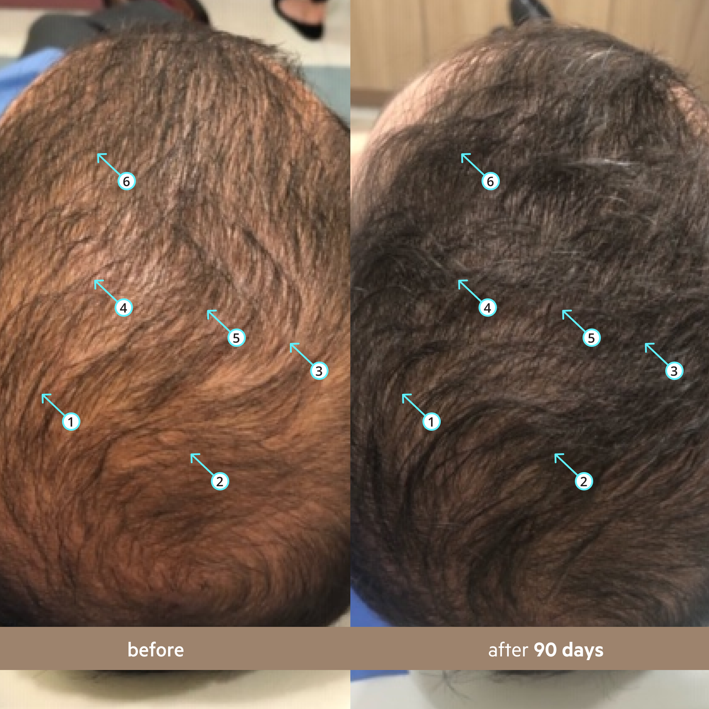 Spectral Men's (DNC-N) | Hair Density Serum with Nanoxidil 5%