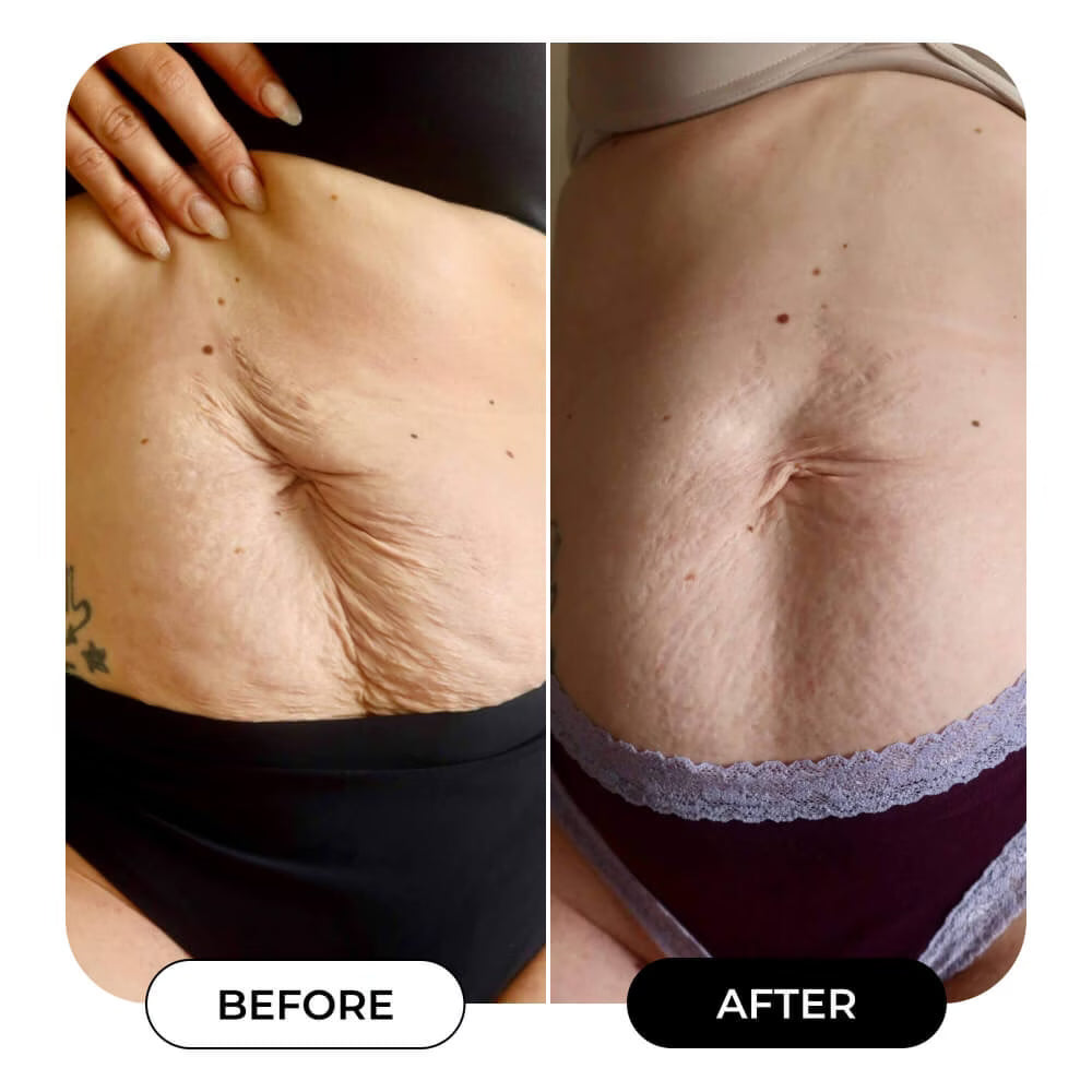 “My skin feels firmer and smoother”