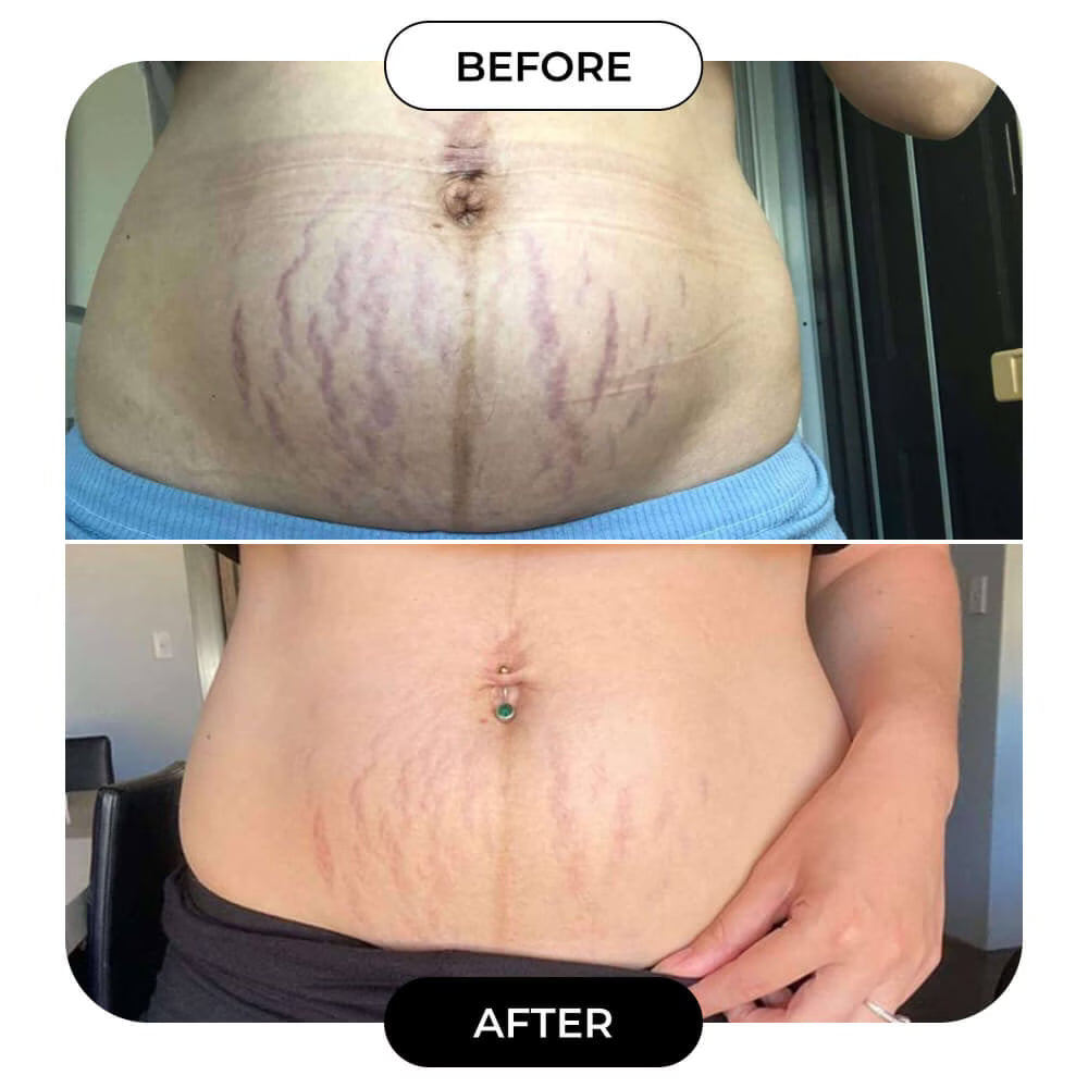 “Visible results in just a few weeks”