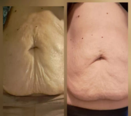&#39;&#39;Miracle Nighttime Toning Cream&#39;&#39;